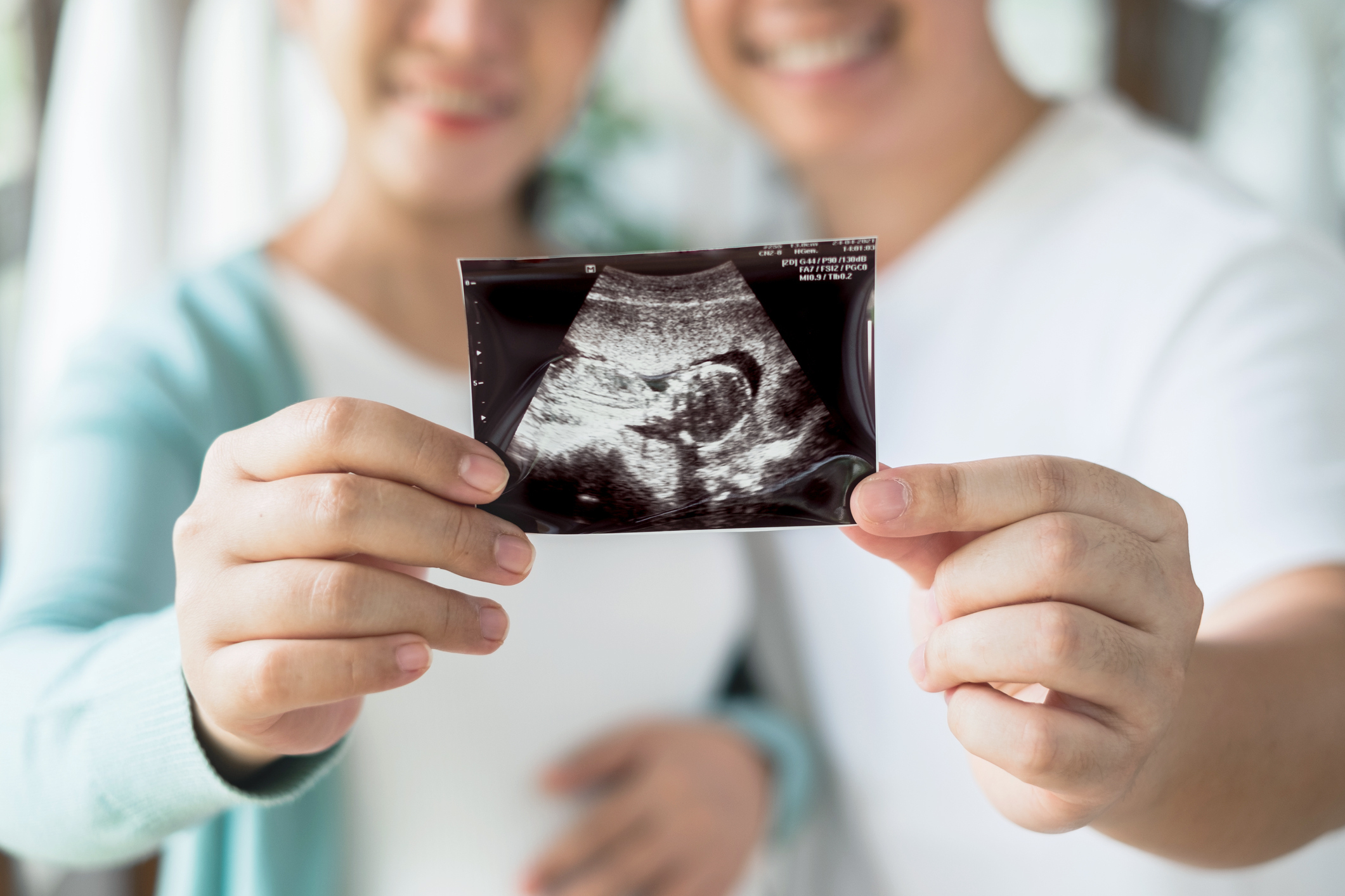 Asian pregnant couple feeling happy show ultrasound image at home, focus on ultrasound image